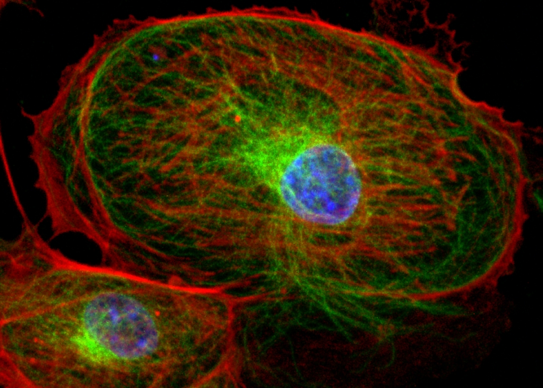 confocal microscopy